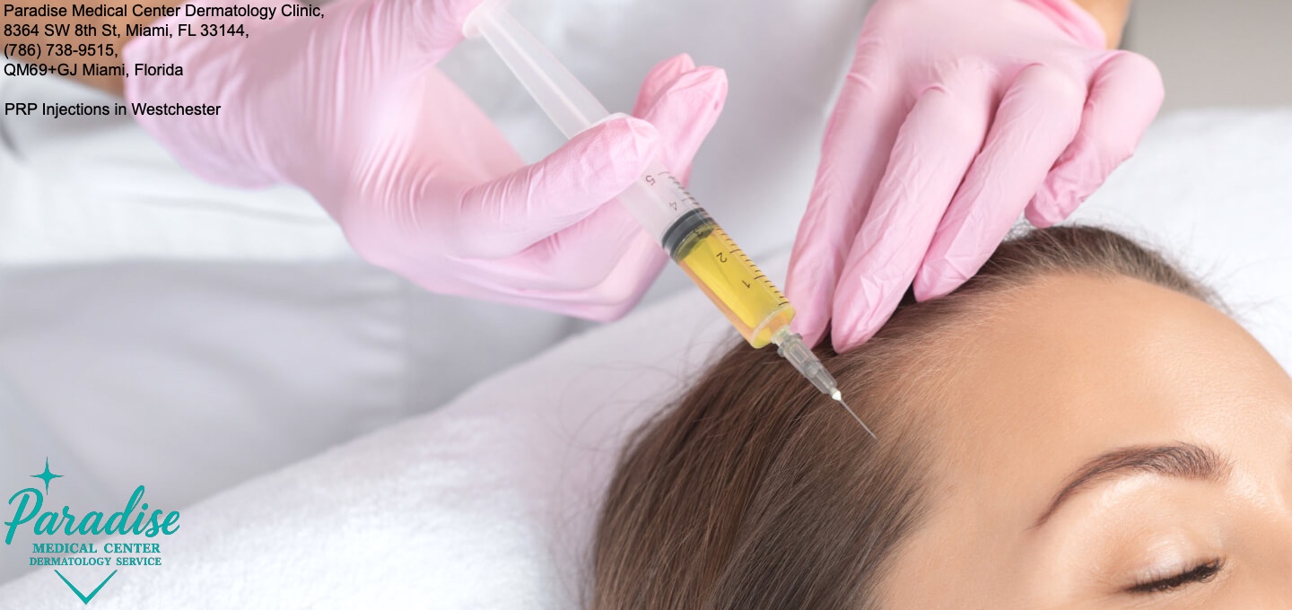 PRP Injections in Westchester, FL - Paradise Medical Center Dermatology Clinic, 8364 SW 8th St, Miami, FL 33144, (786) 738-9515